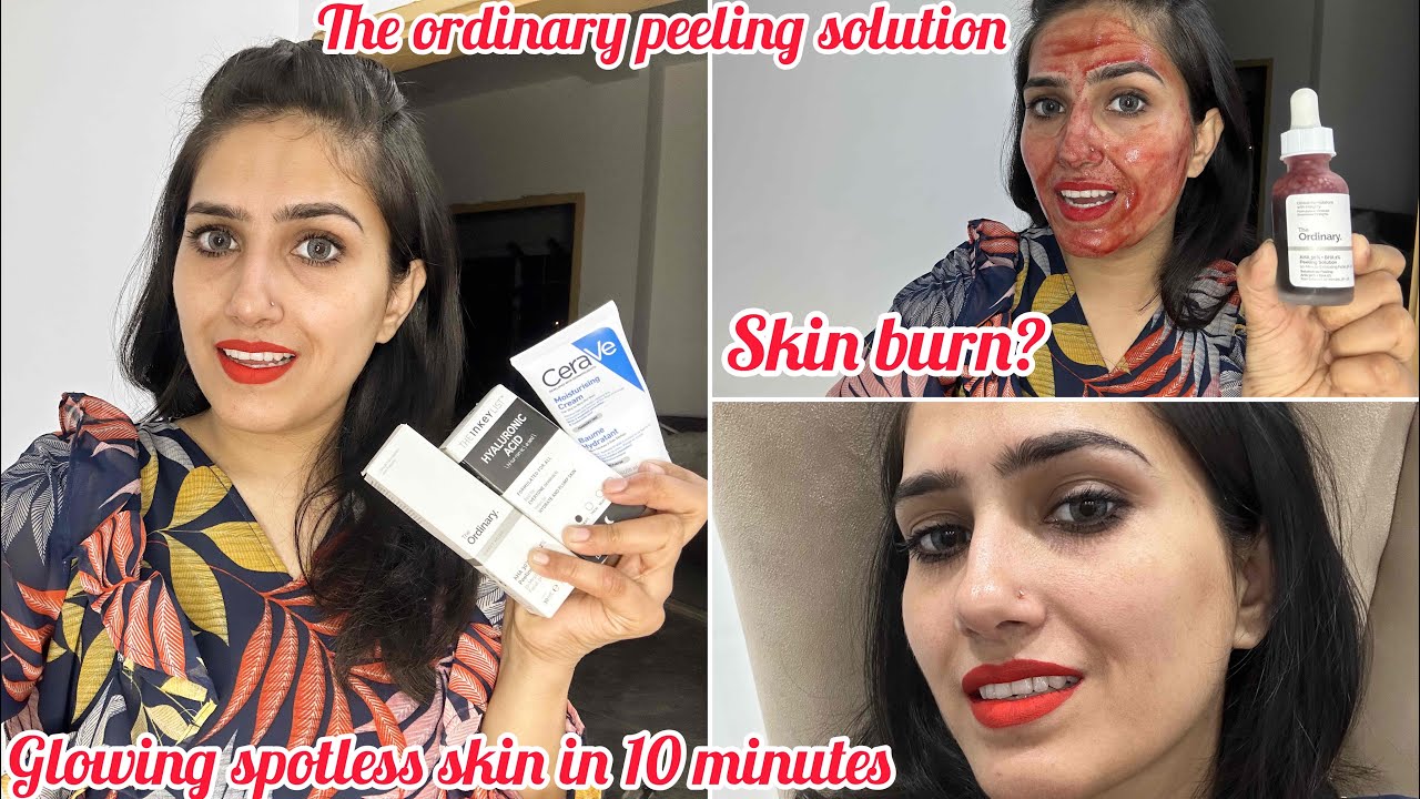 never using the ordinary peel on my face again #theordinary #shorts
