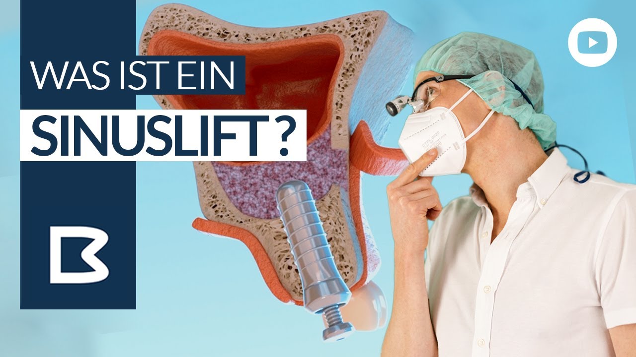 SINUSLIFT - Was wird gemacht & Warum? Animations 3D VIDEO mit genauer Erklärung.