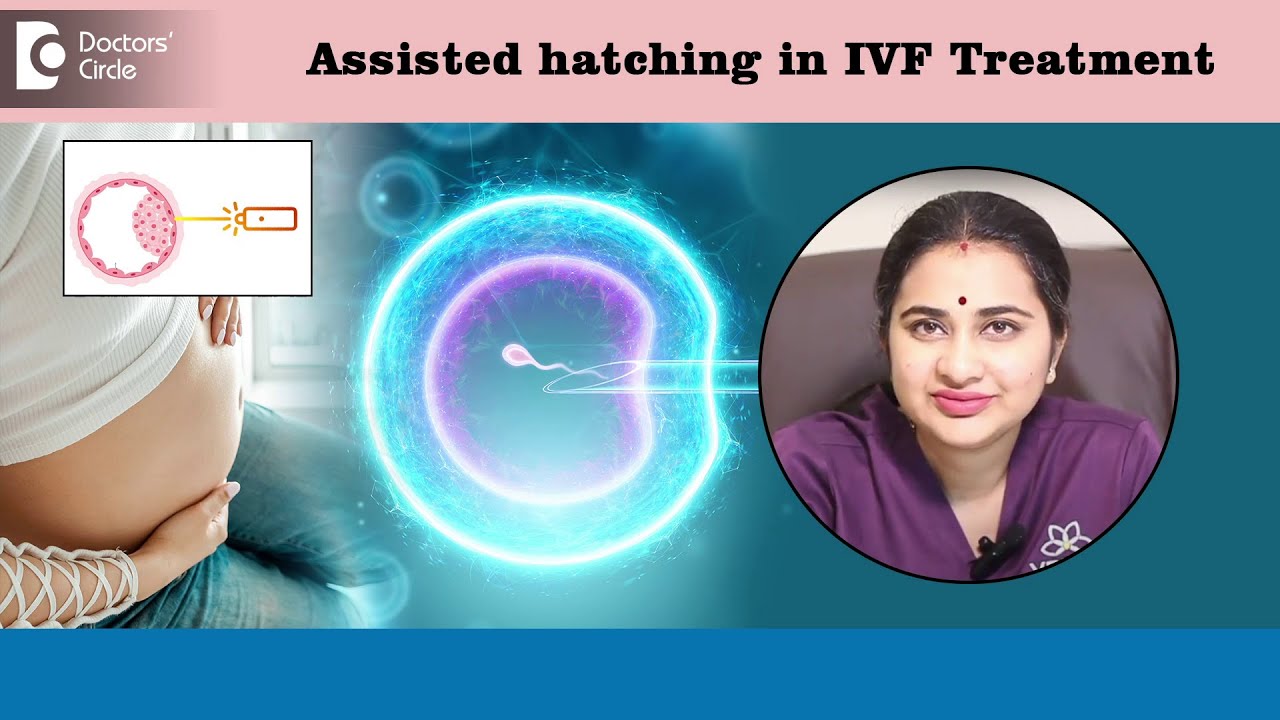When is Assisted hatching done in IVF Treatment?-  Dr. Sneha Shetty | Doctors' Circle