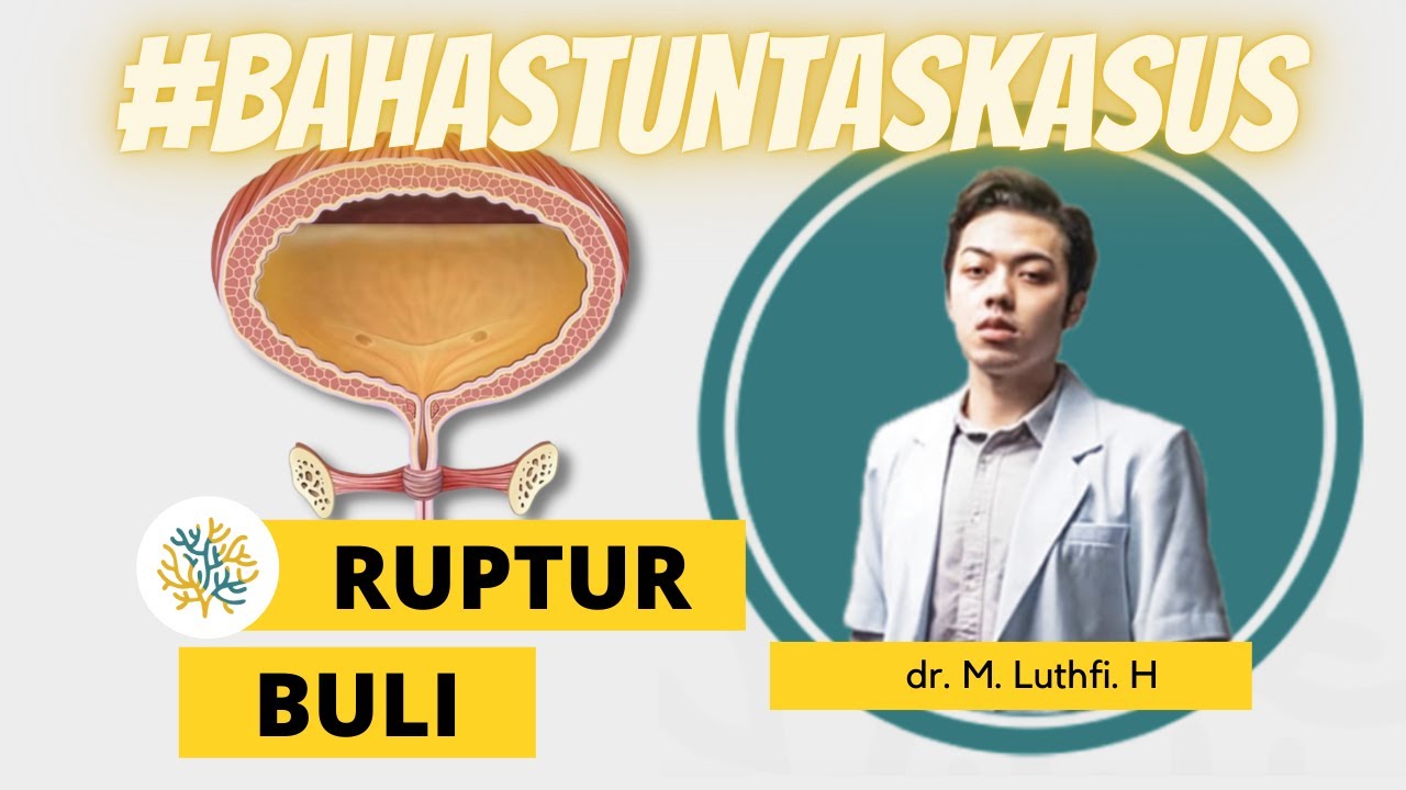 RUPTUR BULI - 