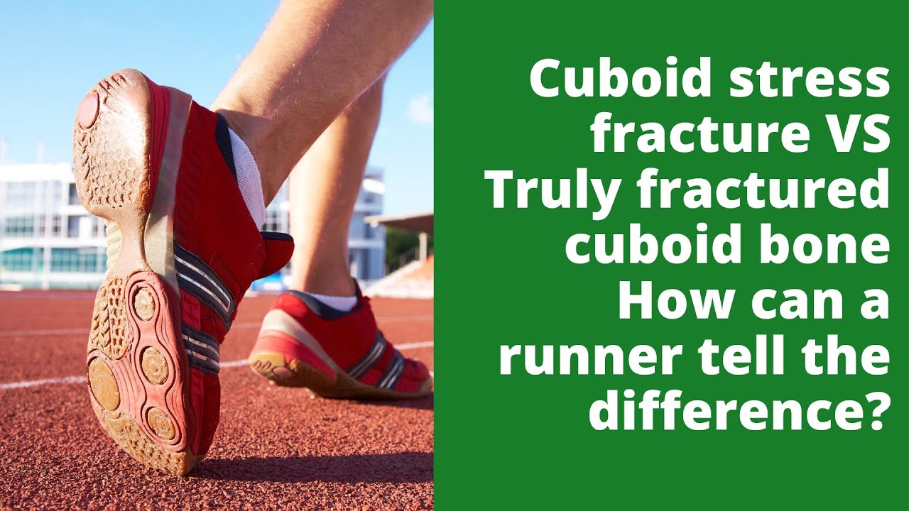 Cuboid stress fracture VS  Truly fractured cuboid bone  How can a runner tell the difference?