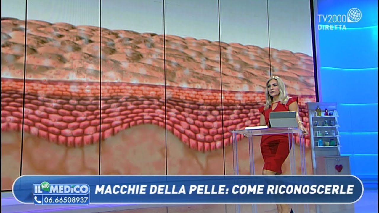 Come rimuovere le macchie della pelle