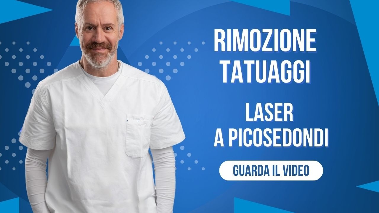 Rimuovere un Tatuaggio fa male? Il Dott. Campione spiega costi, tempi e dolore.