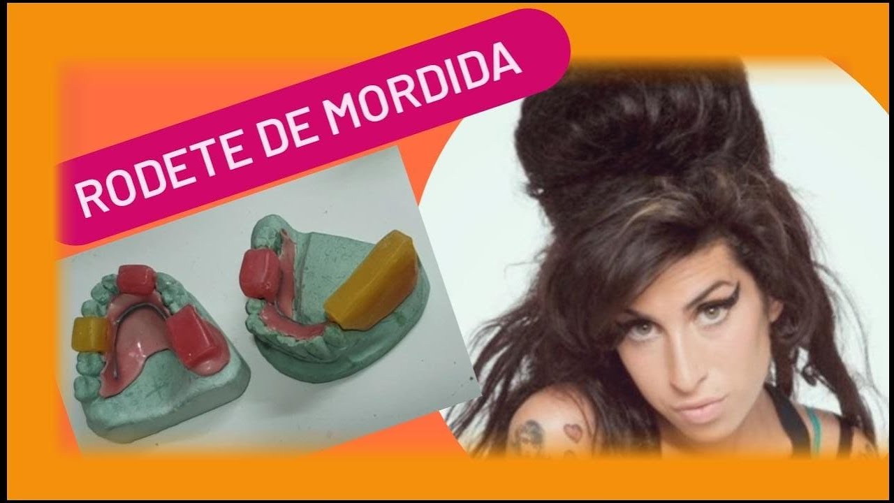 Como hacer un rodete de mordida en una protesis parcial
