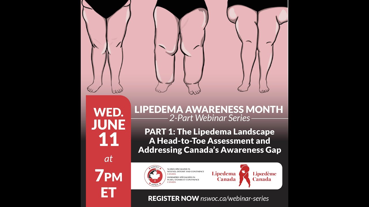 The Lipedema Landscape – A Head-to-Toe Assessment and Addressing Canada’s Awareness Gap