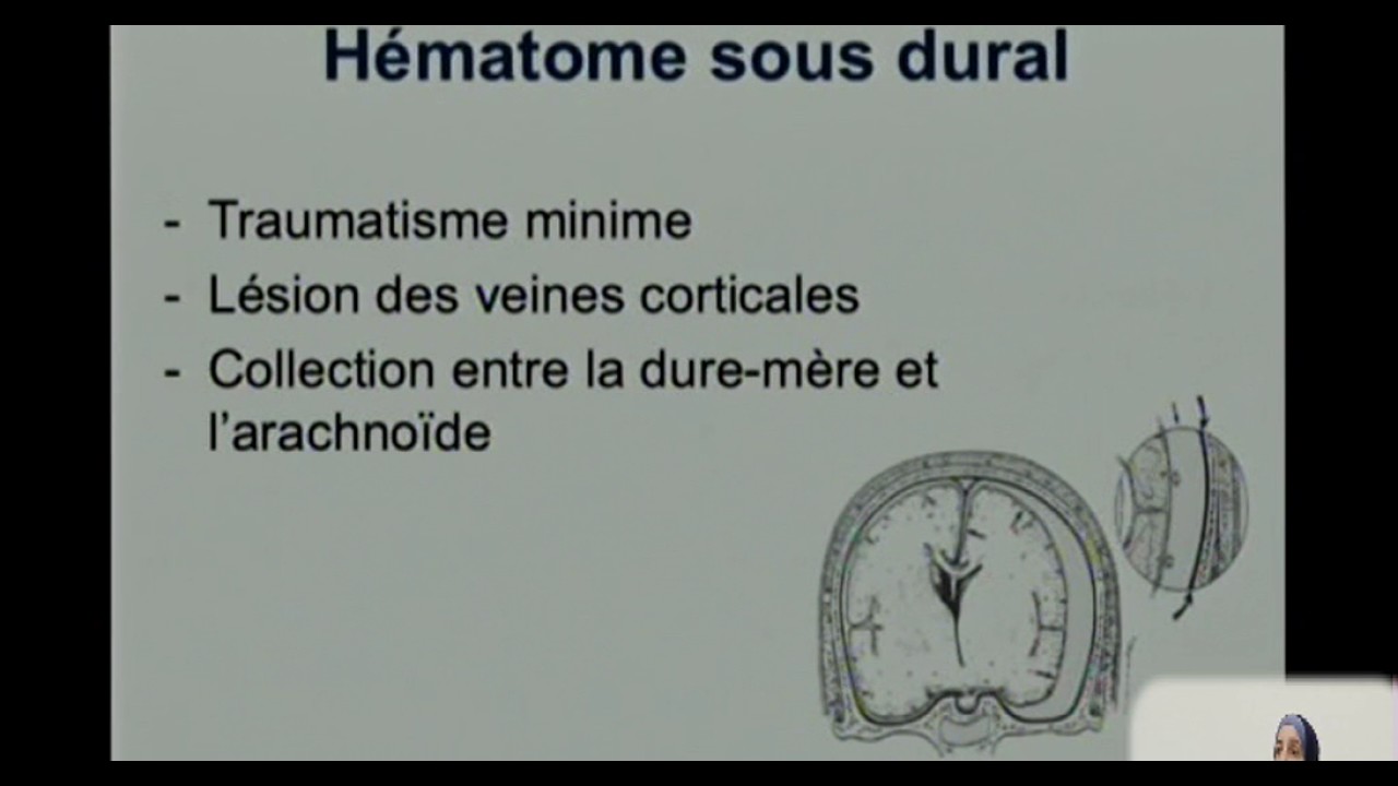 FMPM MOOCs - Exploration radiologique des traumatismes crâniens - Pr. Idrissi