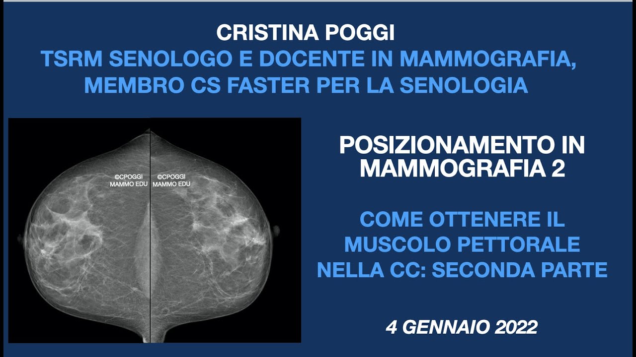COME OTTENERE IL MUSCOLO PETTORALE NELLA CC: SECONDA PARTE