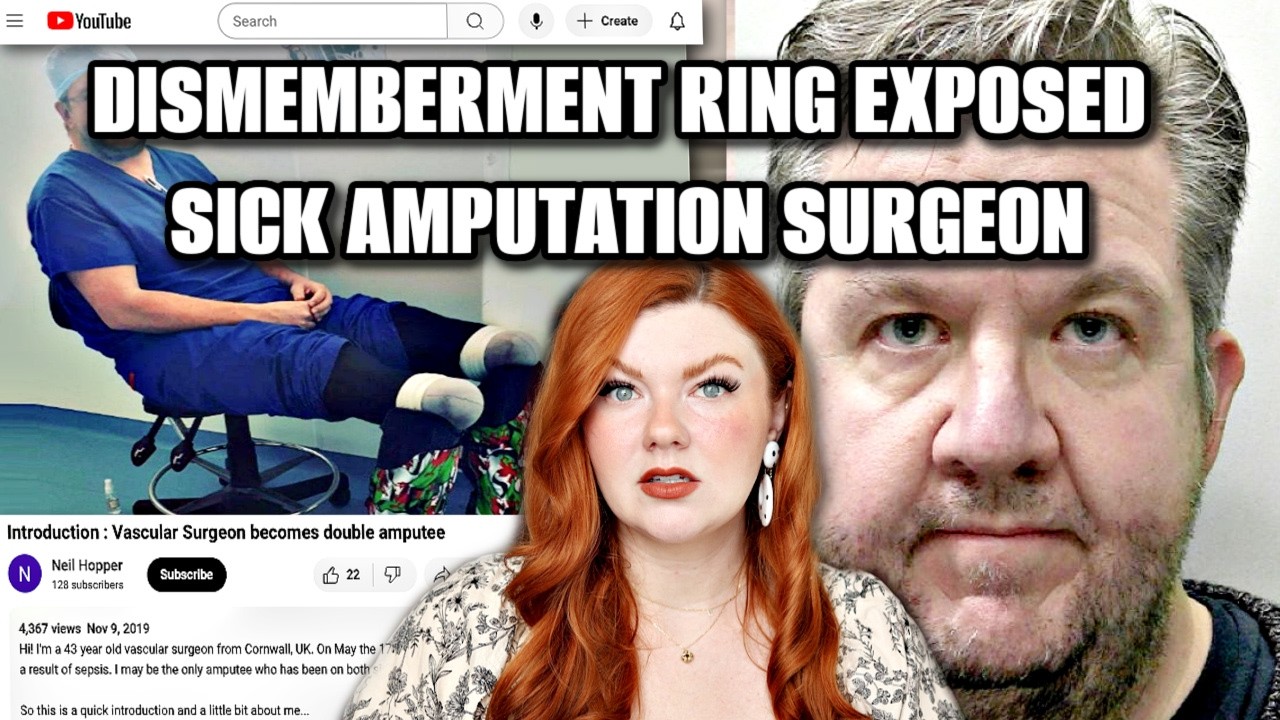 Amputation Surgeon Linked to Online DISMEMBERMENT Ring Selling Body Parts?!