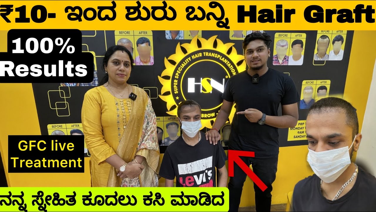 ₹10/- BEST PRICE IN KARNATAKA FOR HAIR TRANSPLANT AND BEARD TRANSPLAT || HSN HAIR TRANSPLANT