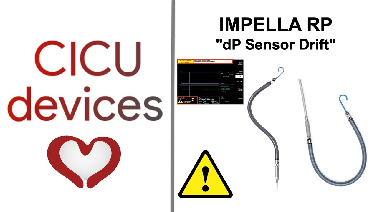 ⚠️ IMPELLA RP & RP FLEX, SAFETY ALERT: DIFERENTIAL PRESSURE SENSOR DRIFT (SAFETY ALERT 2026-02)