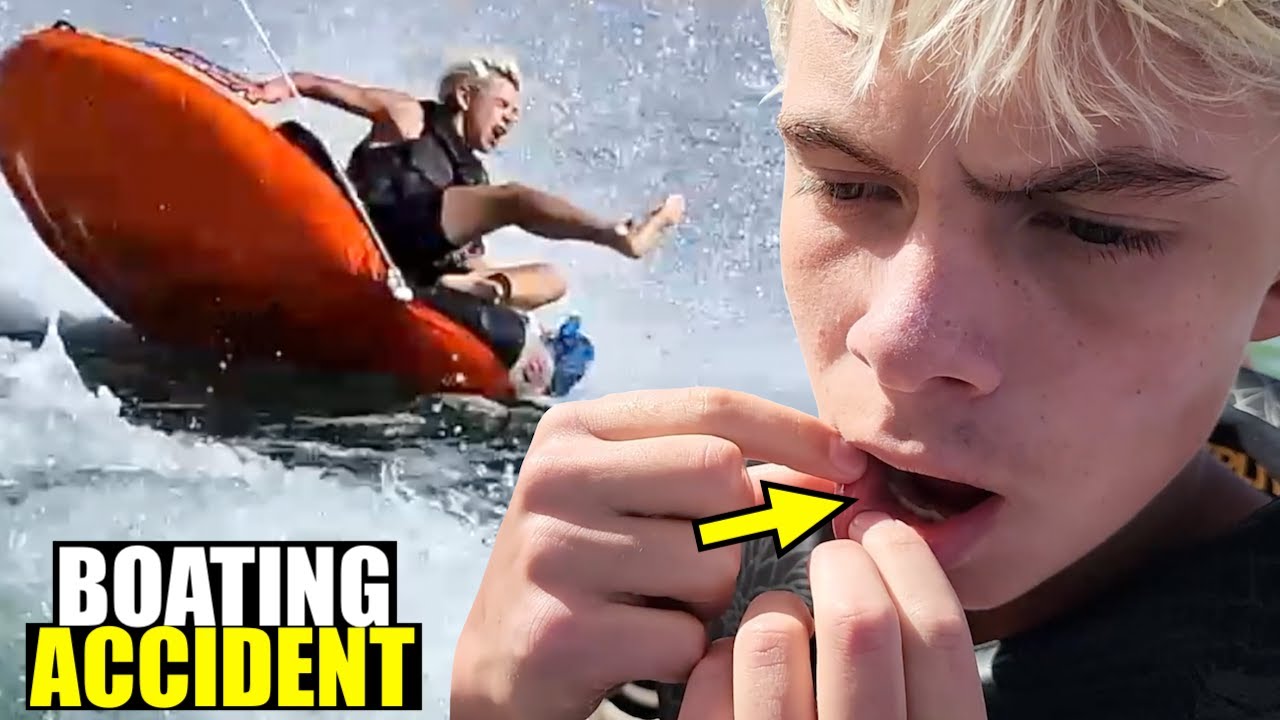 TOOTH WENT THROUGH HIS LIP at LAKE POWELL! 😱
