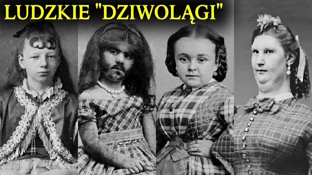 Szokujące historie „ludzkich dziwolągów”, w które trudno uwierzyć