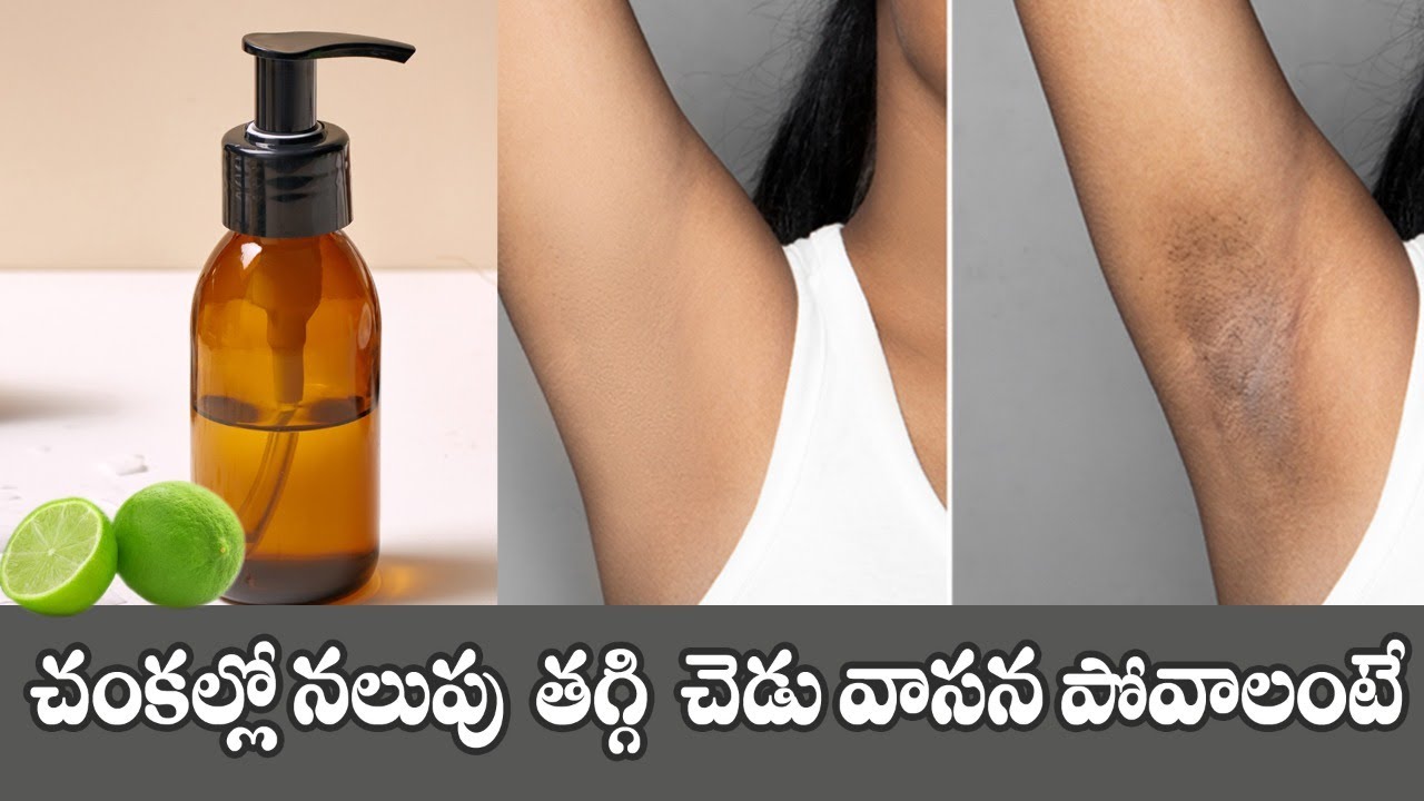 Dark Underarms Remedy | How to Get Rid of Dark Armpits | Reduces Bad Odor |Dr.Manthena's Health Tips