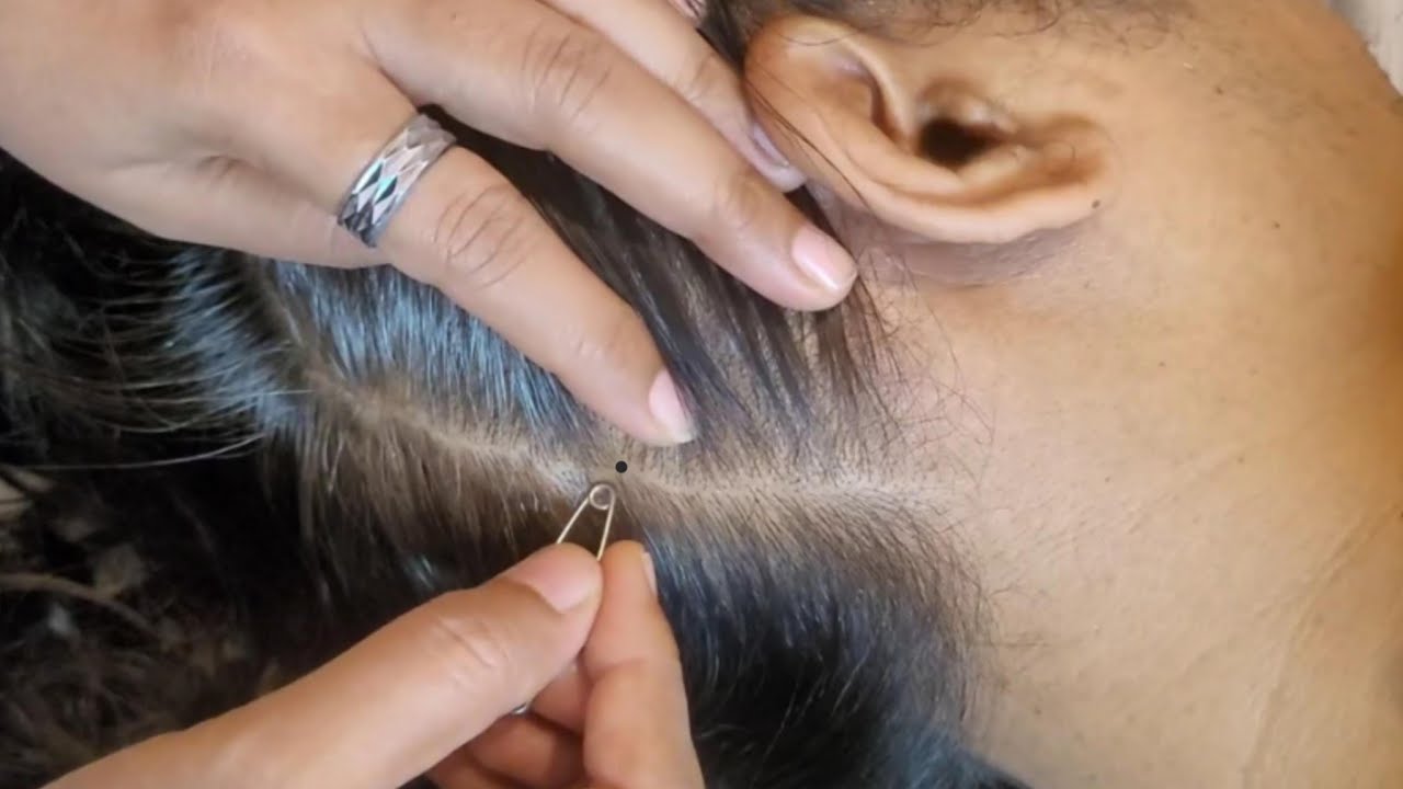 ASMR For People who Need Sleep Fast , Scalp Scratching & Scalp Checking (Close Up)🌿✨