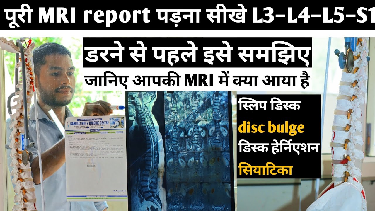how to read lumbar spine mri report, l4-l5-s1, spine mri report kaise dekhe, back pain, sciatica