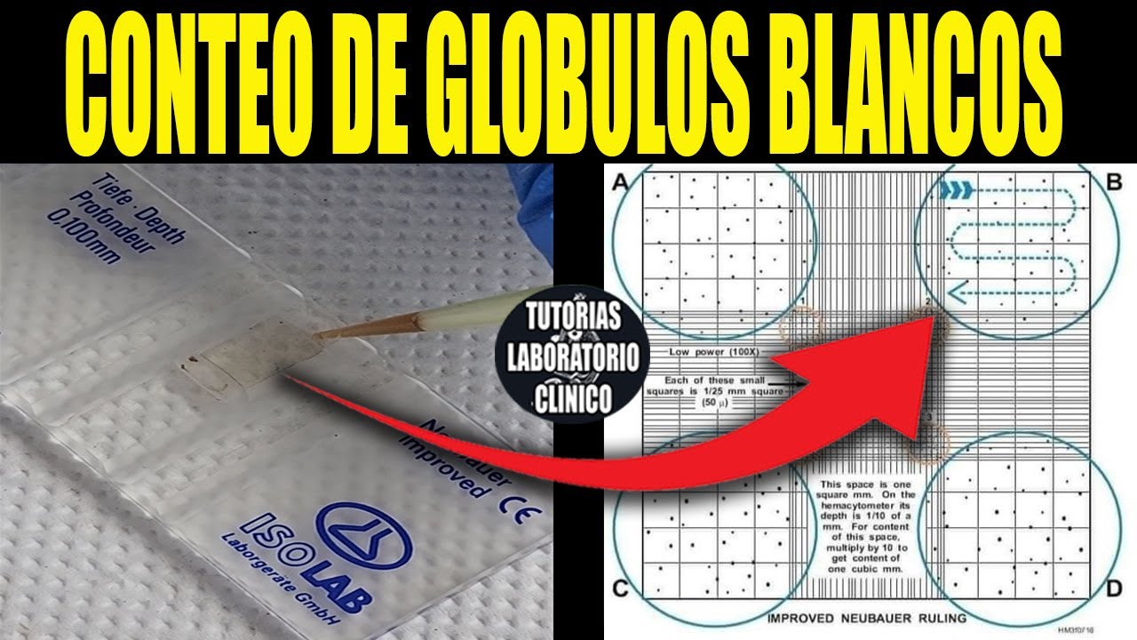 🩸Como Hacer el Conteo de GLÓBULOS BLANCOS en Cámara de Neubauer-Procedimiento (Laboratorio Clínico)🔬