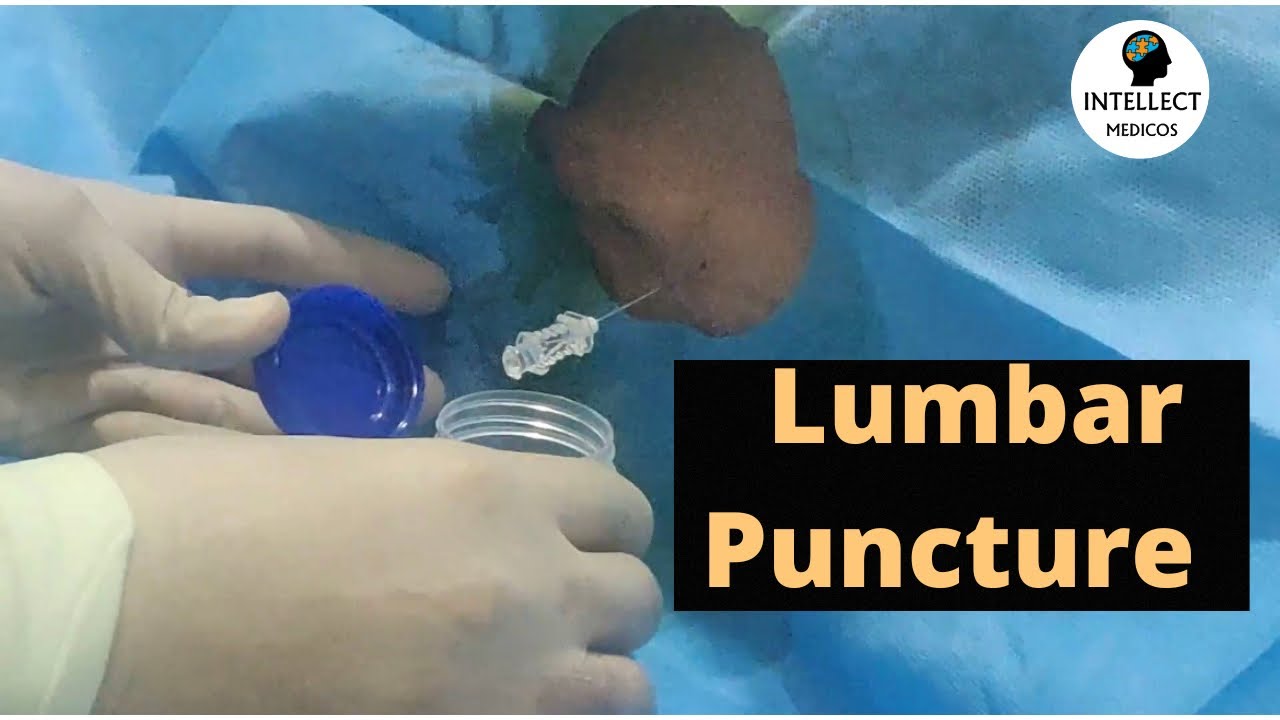 Lumbar Puncture Procedure (in just 11 mins)
