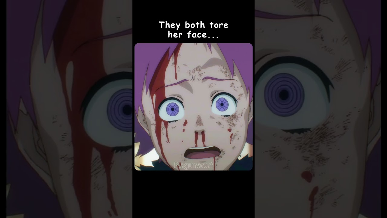 He bit in her face 😰 #anime #shorts