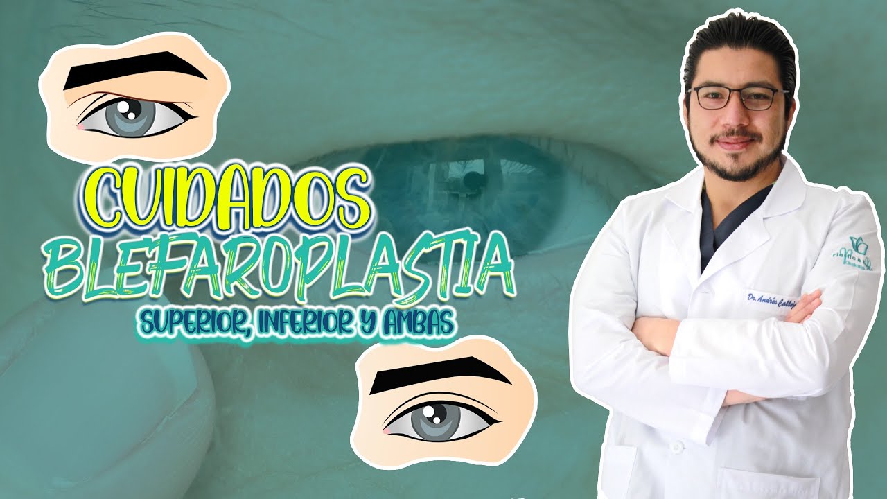 Cuidados después de una Blefaroplastia