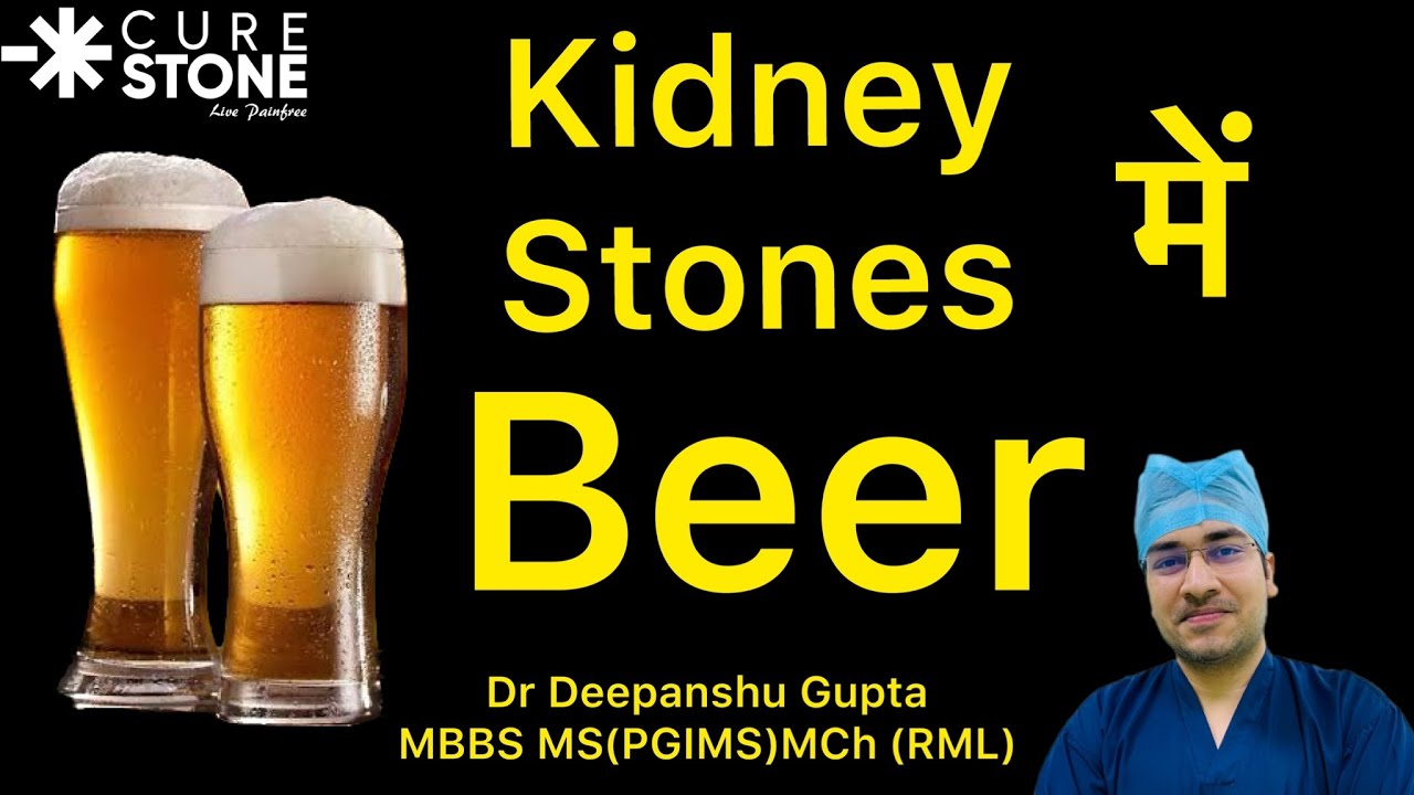 Beer for Kidney Stone | क्या बियर पीने से पथरी निकल जाती है? - Dr. Deepanshu Gupta #beer #stone