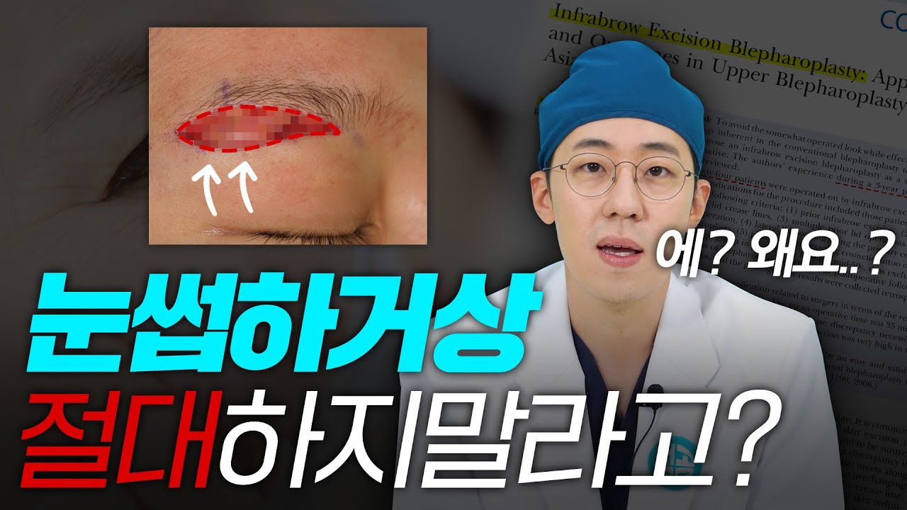 눈썹하거상 절대 하지 말라고🤦‍♀️?  왜요..?       #눈썹하거상 #눈성형 #중년성형