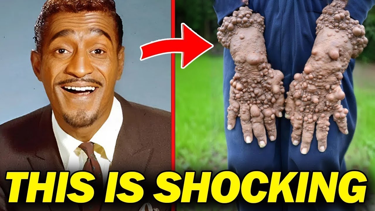 Black Celebrities With Unique Features That Made Them Icons