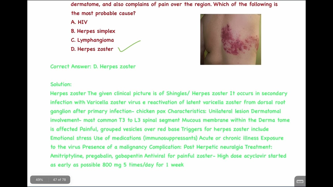 Dermatology PYQ Recall INICET 2021 May + Nov. #inicet #inicetrecall 