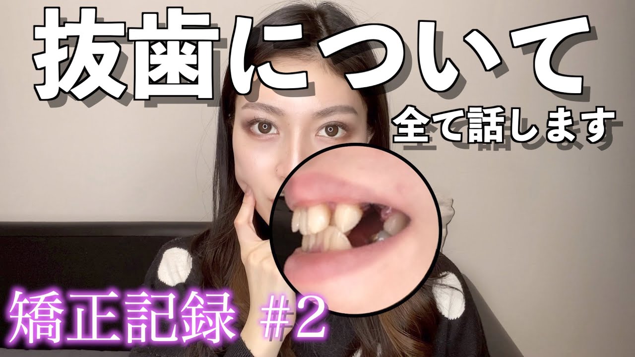 【4本抜歯】麻酔が効かなくて痛すぎた…【八重歯の歯列矯正】矯正記録 #2
