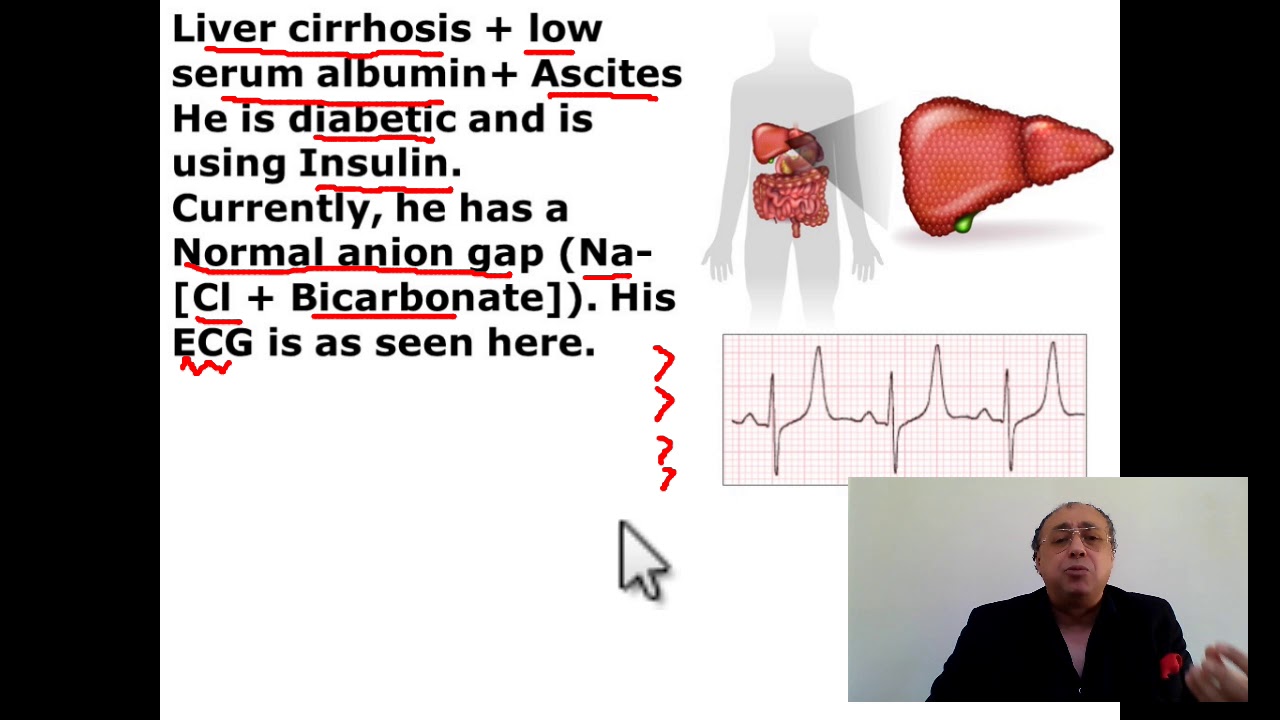 Anion Gap + low albumin level #cme #internal_medicine #medical  #doctor #محاضرات_باطنة