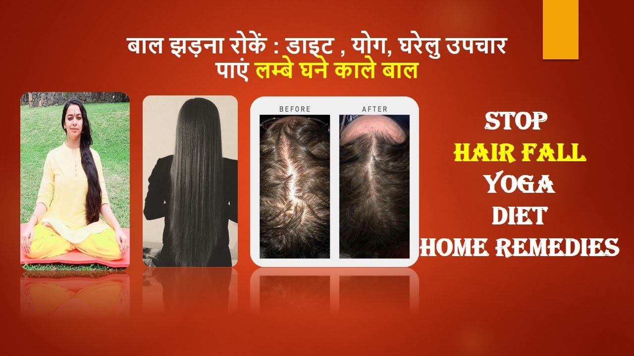 बाल झड़ना रोकें:लम्बे घने काले बाल :डाइट ,योग, घरेलु उपचार |YOGA, DIET, HOME REMEDIES FOR HAIR GROWTH