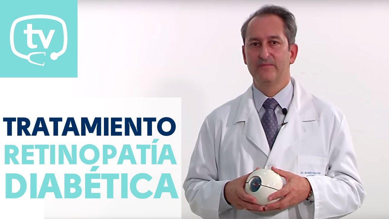 El tratamiento de la retinopatía diabética