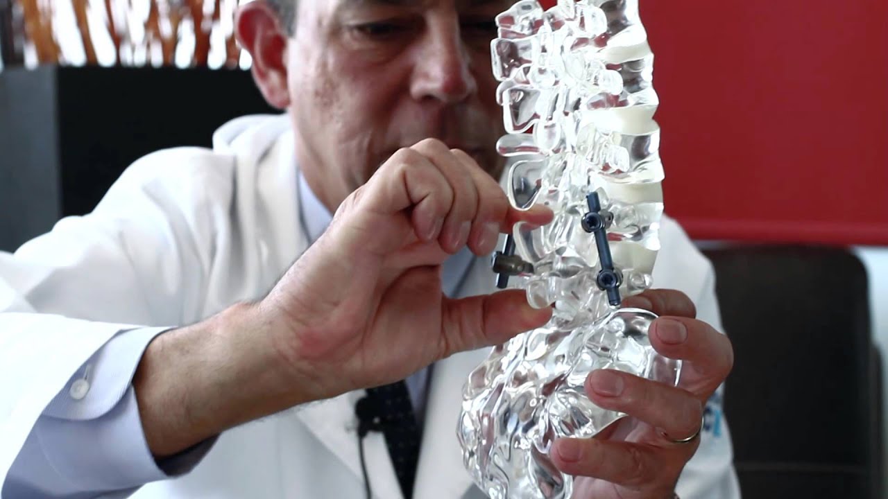 Minimally Invasive​ Spine Surgery Vs. Fusion or Stabilization for  1/3 U.S. prices