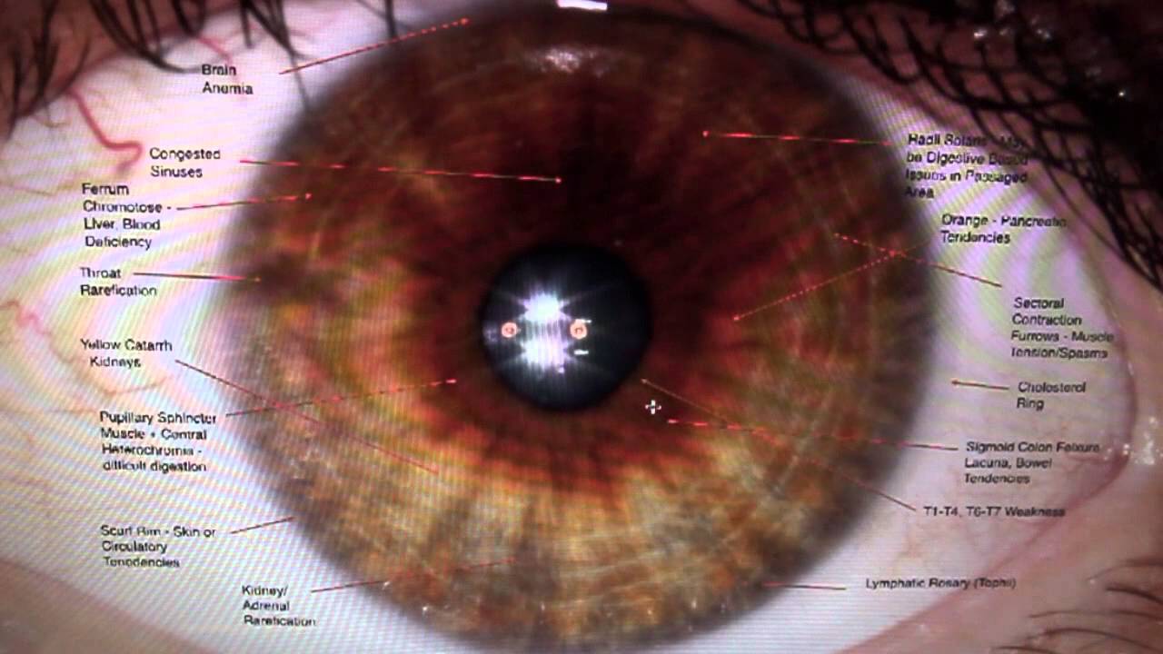 Iridology Reading, Part I