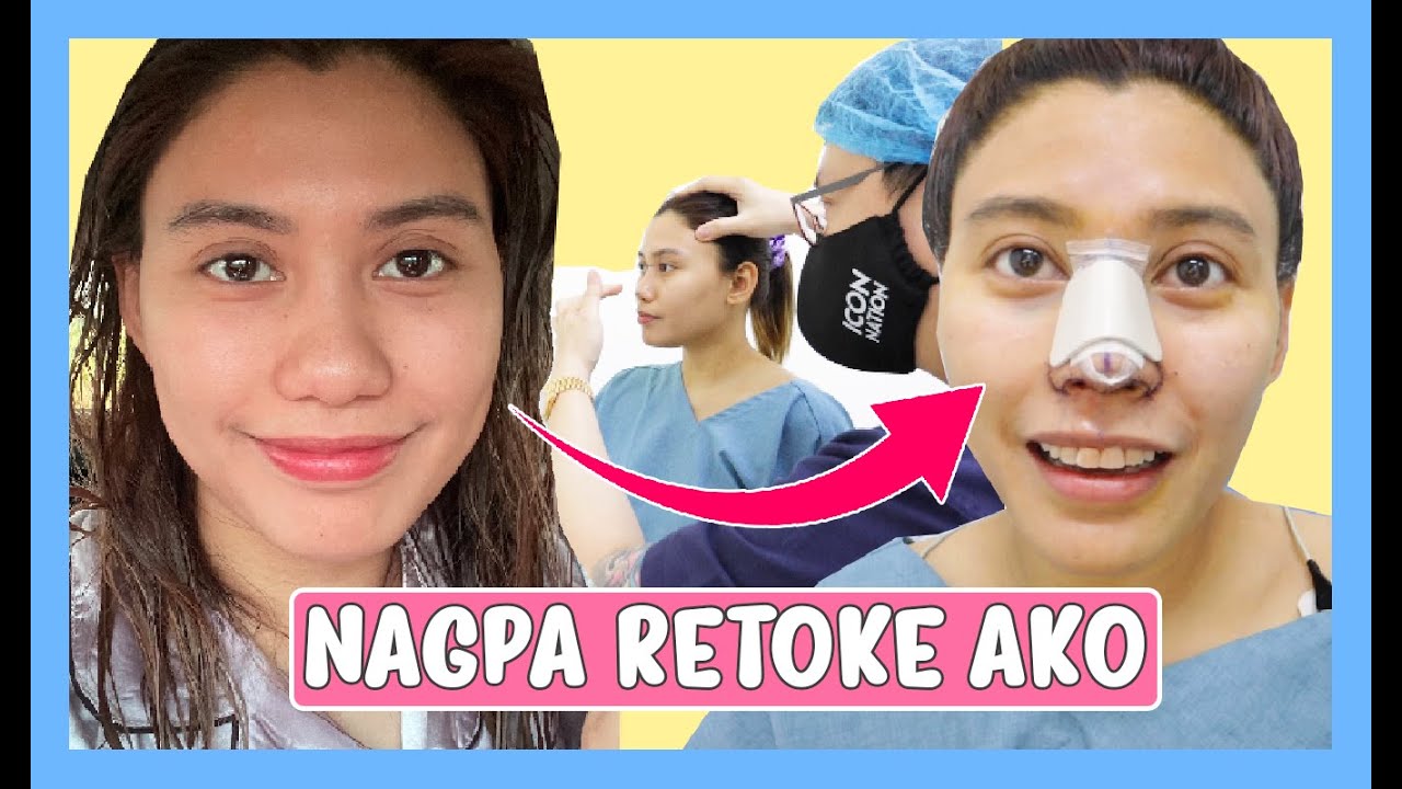 RHINOPLASTY PROCEDURE | The Icon Clinic 💜 Nanay Isha