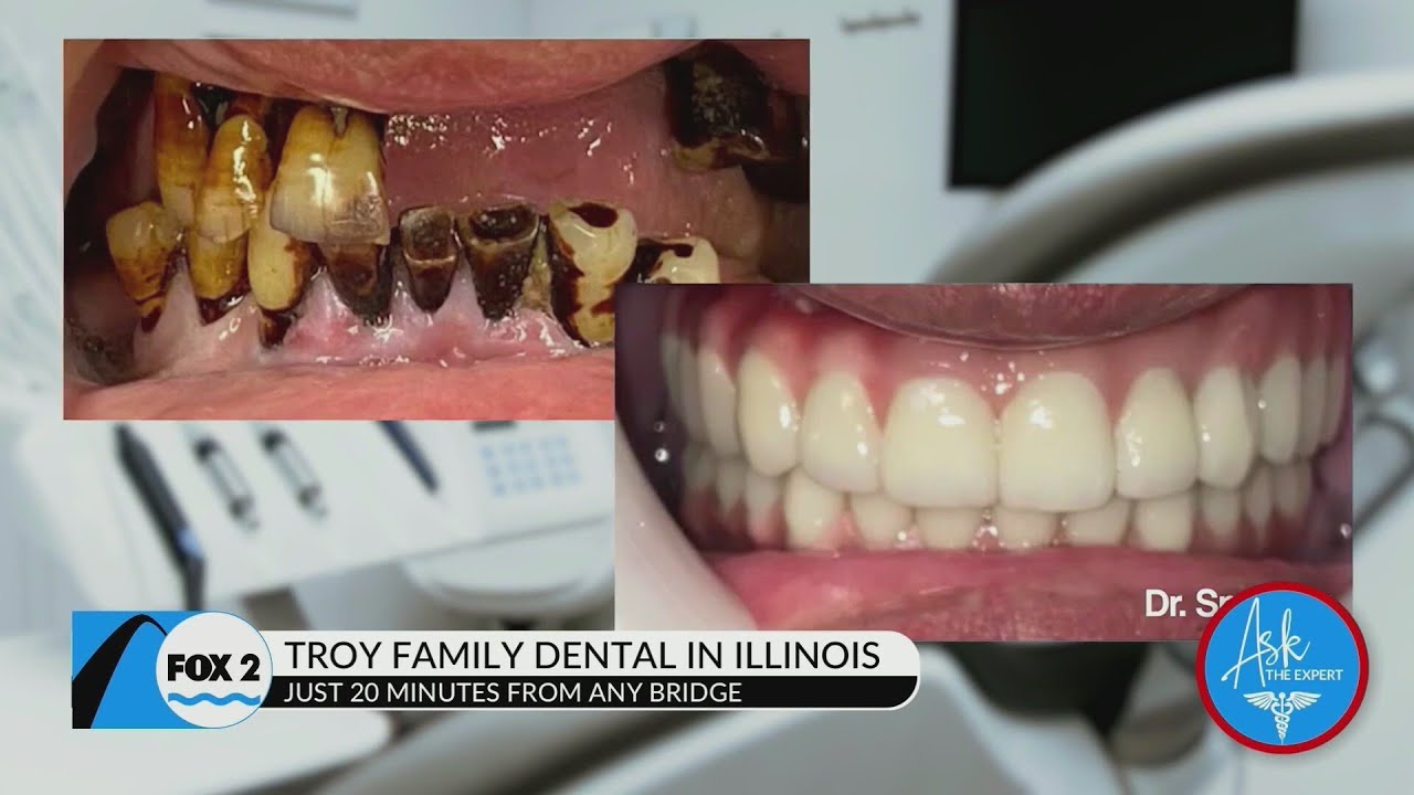 Get dental implants that look real and act like original teeth at Troy Family Dental!