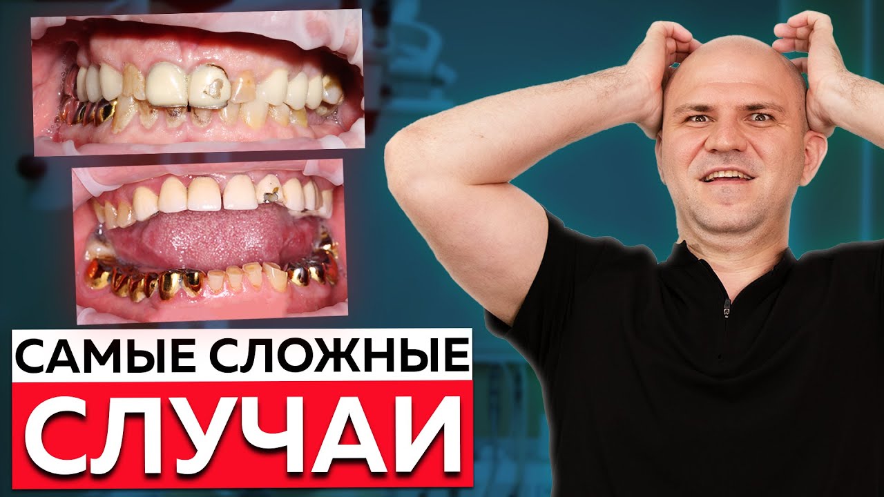 Вернули 10 лет жизни клиенту! Топ 3 самых сложных стоматологических случаев