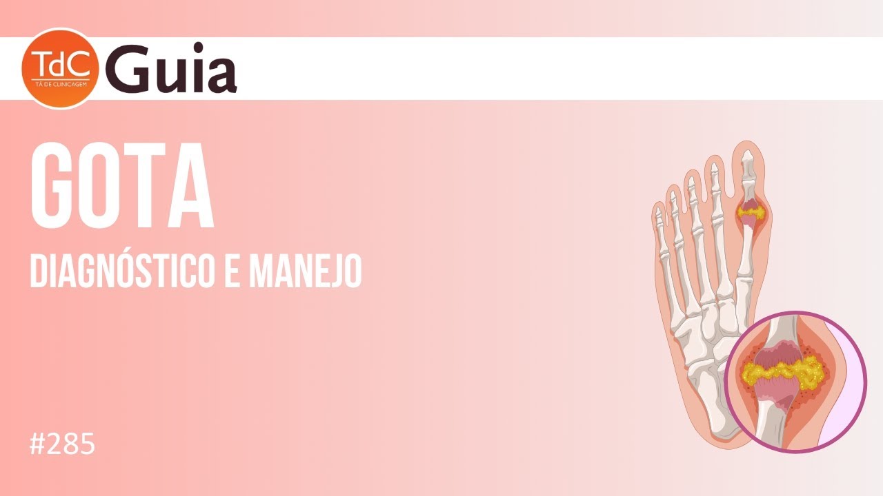 EPISÓDIO 285: Manejo e Diagnóstico da Gota