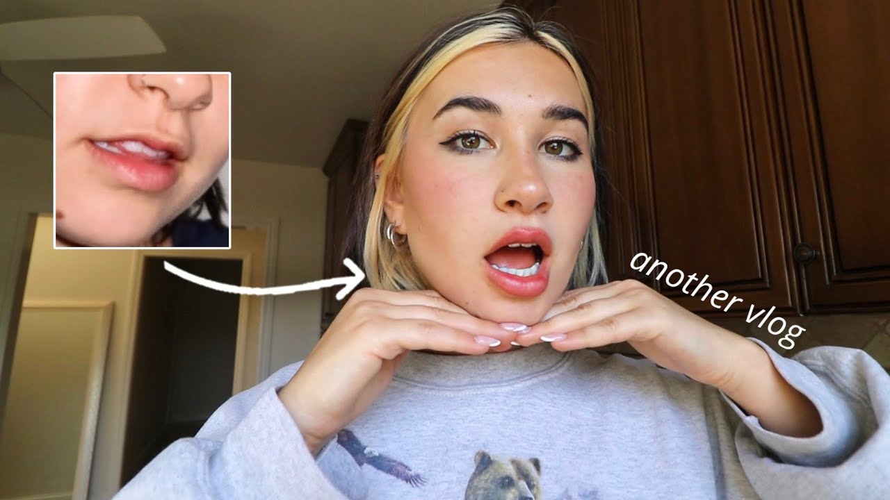 getting my lips done for the first time