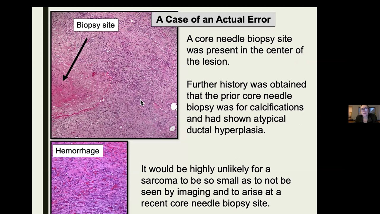 LMP Grand Rounds SLester 7Oct2020