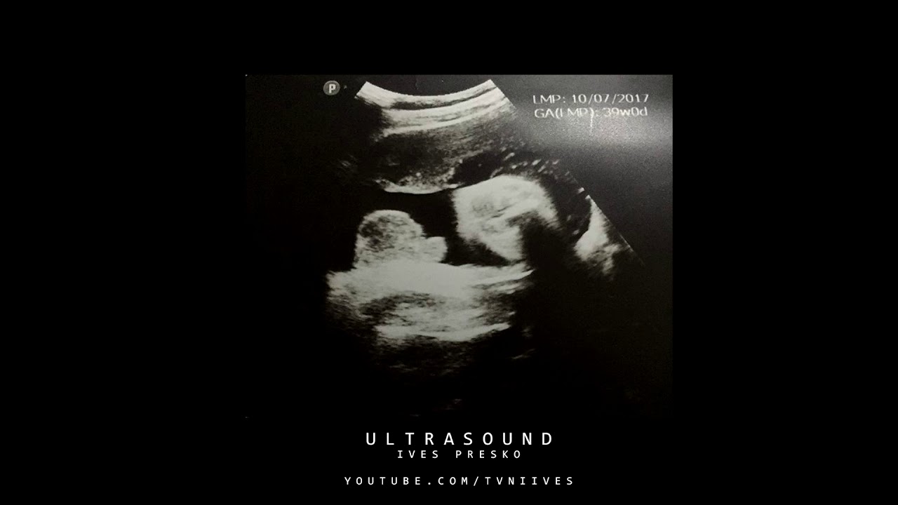 Ives Presko - Ultrasound