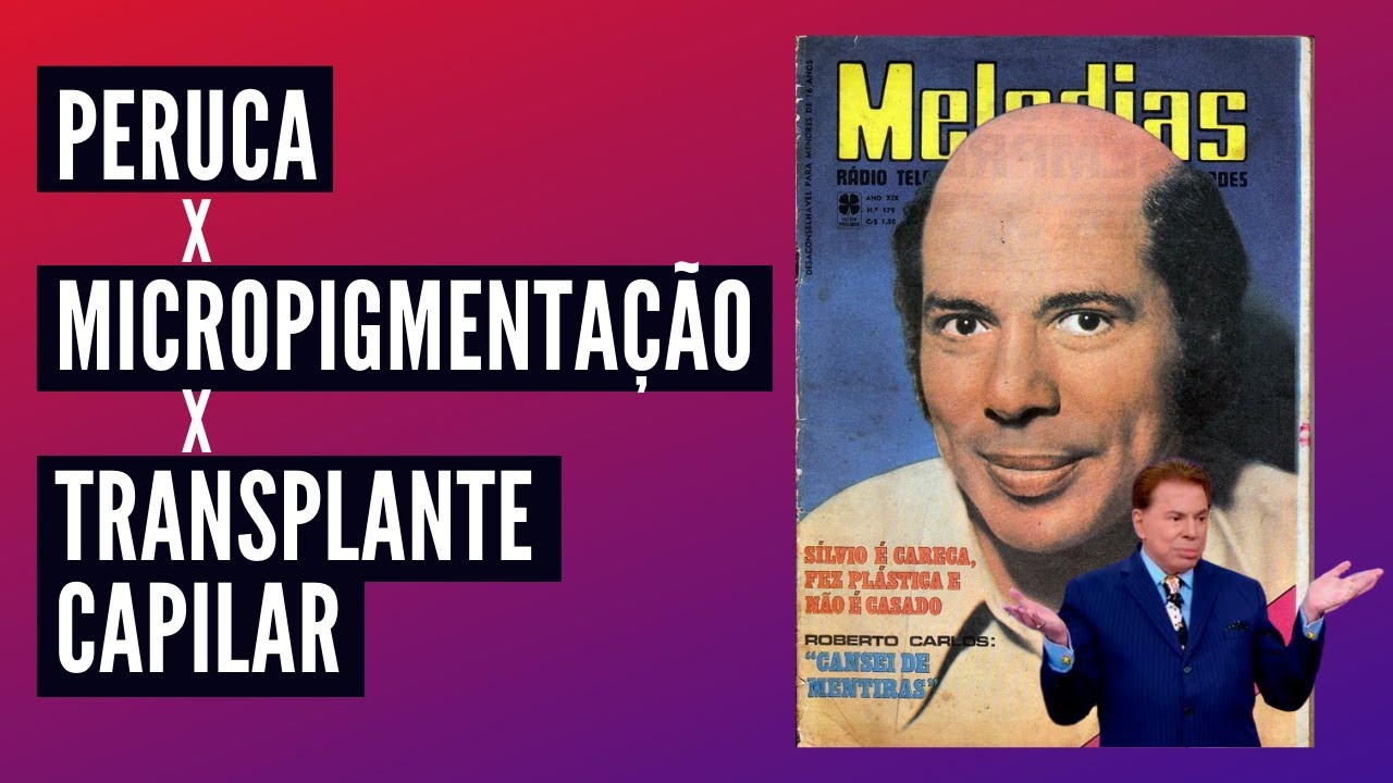 Qual diferença transplante , prótese capilar e micropigmentação ? Silvio Santos é #calvo? #careca ?