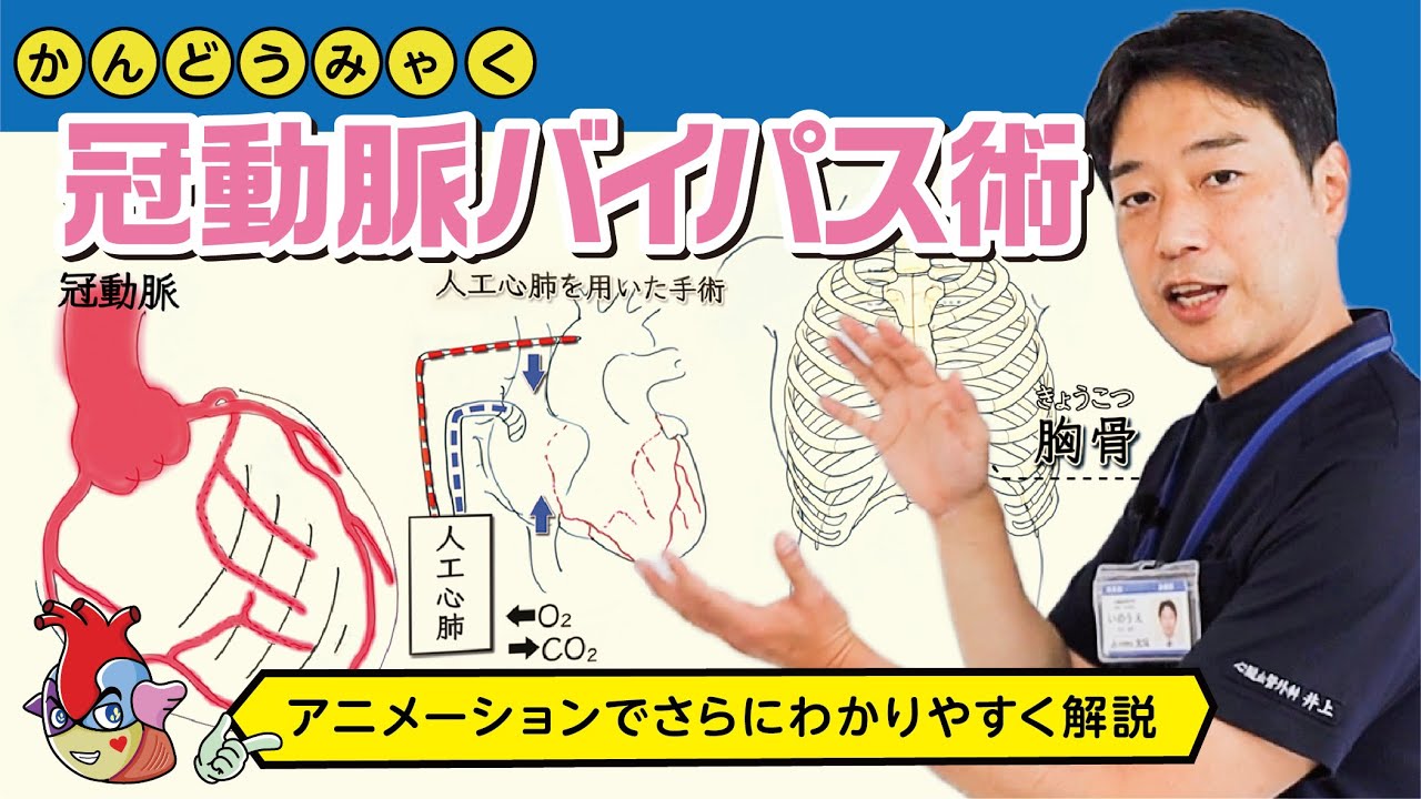 冠動脈バイパス手術についてわかりやすく解説