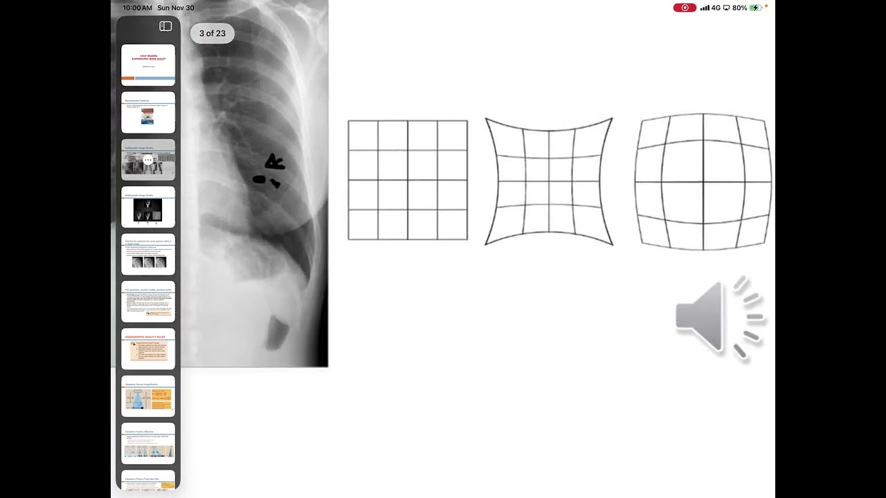 X-ray quality 1
