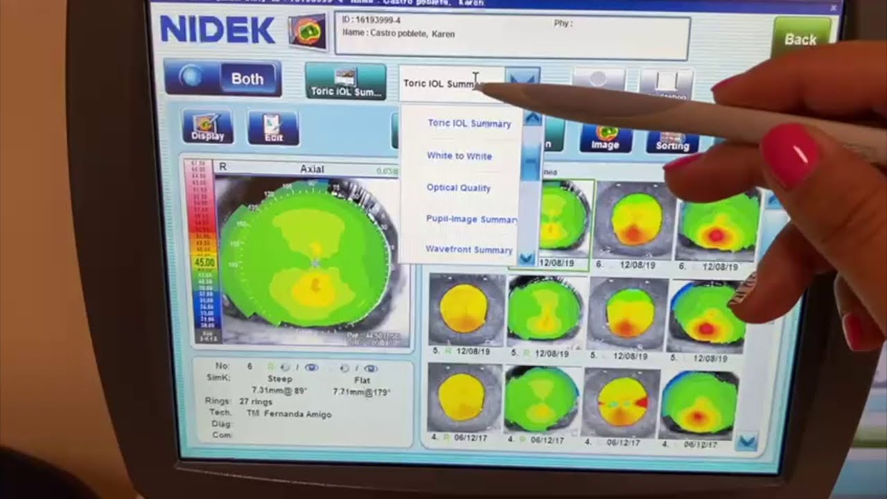 TOPÓGRAFO CORNEAL OPD SCAN III - NIDEK