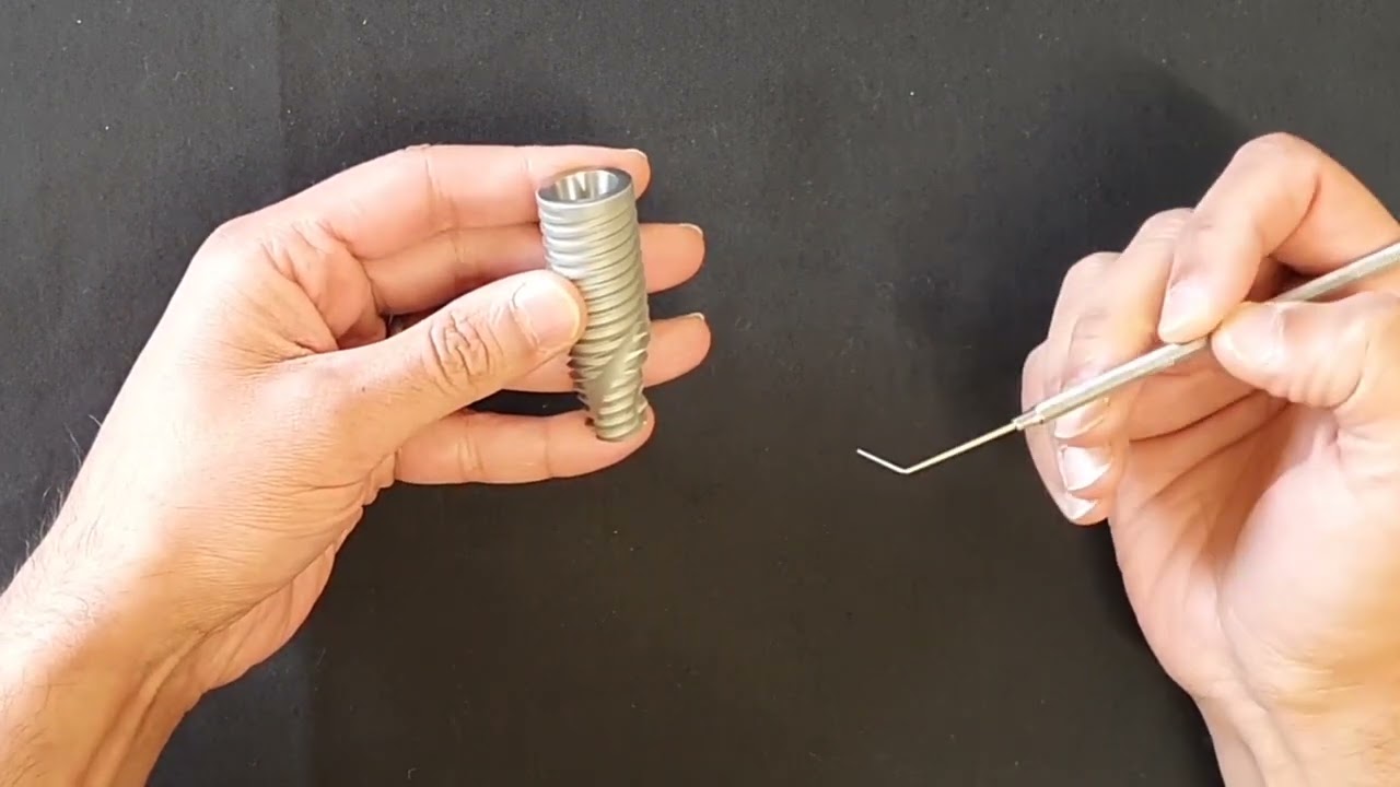 Neodent GM Helix Dental Implant