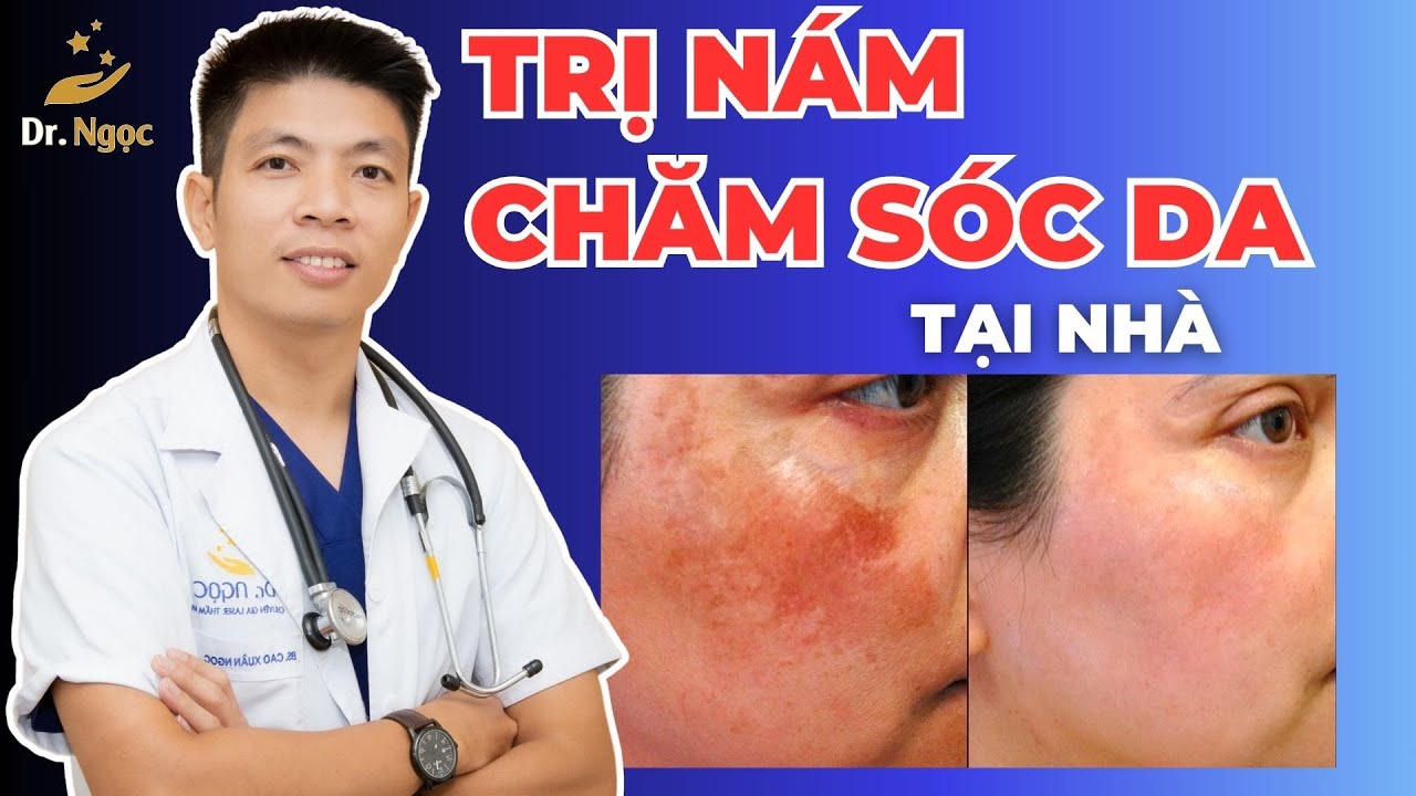 Trị Nám Da, Chăm Sóc Da tại nhà cùng Dr Ngọc