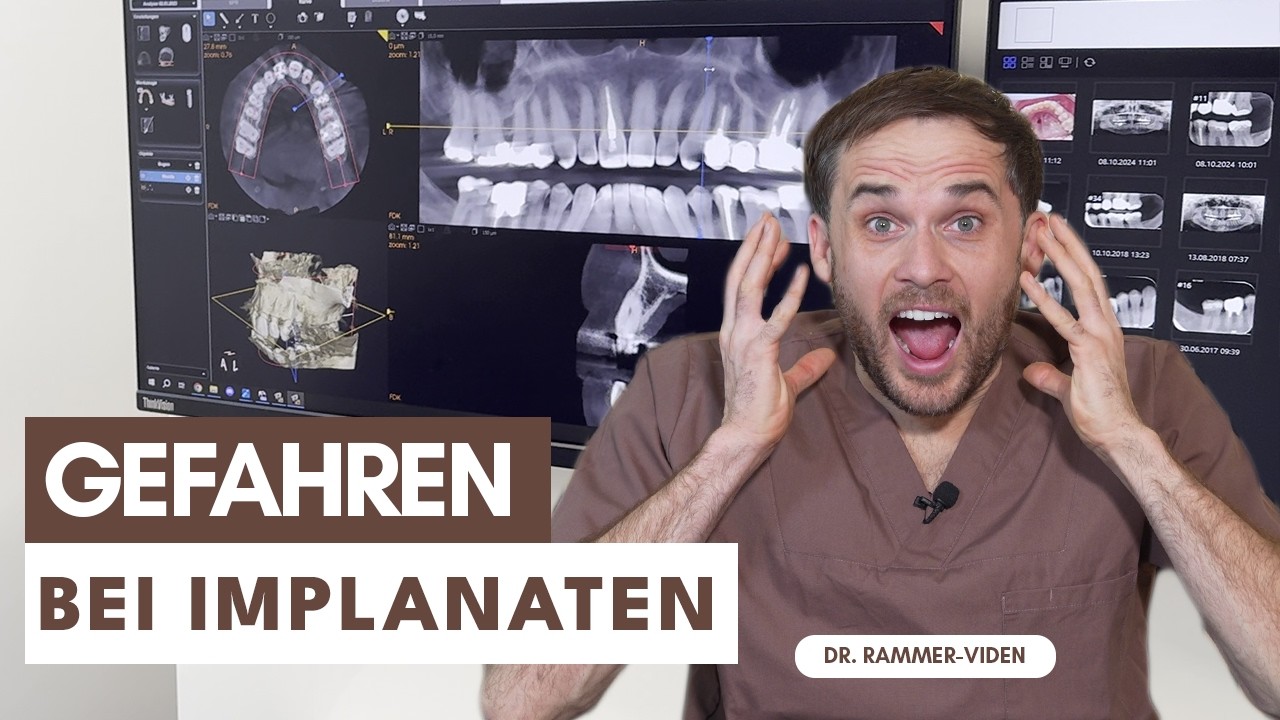 Die 4 größten Gefahren bei Zahnimplantaten – und wie du sie vermeidest