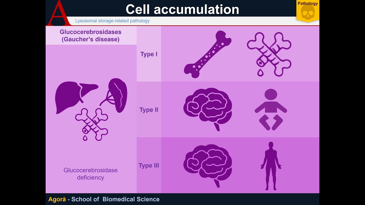 Cellular Pathology - Autophagy and lysosomal storage