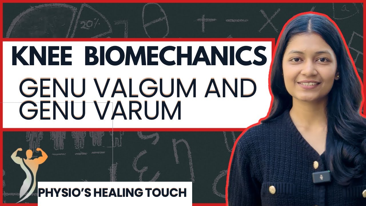 KNEE VALGUM & KNEE VARUM | KNEE BIOMECHANICS | PHYSIOTHERAPY