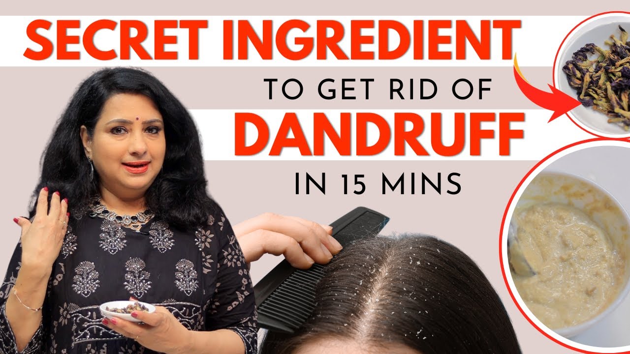 Weekly Once இத பண்ணுங்க! Best Home Remedy For Dandruff & Hair Fall - Vasundhara's Hair Care Tips